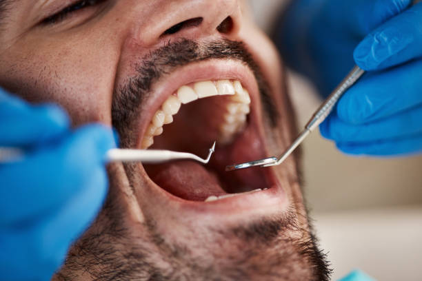 Full Mouth Reconstruction in Landover, MD